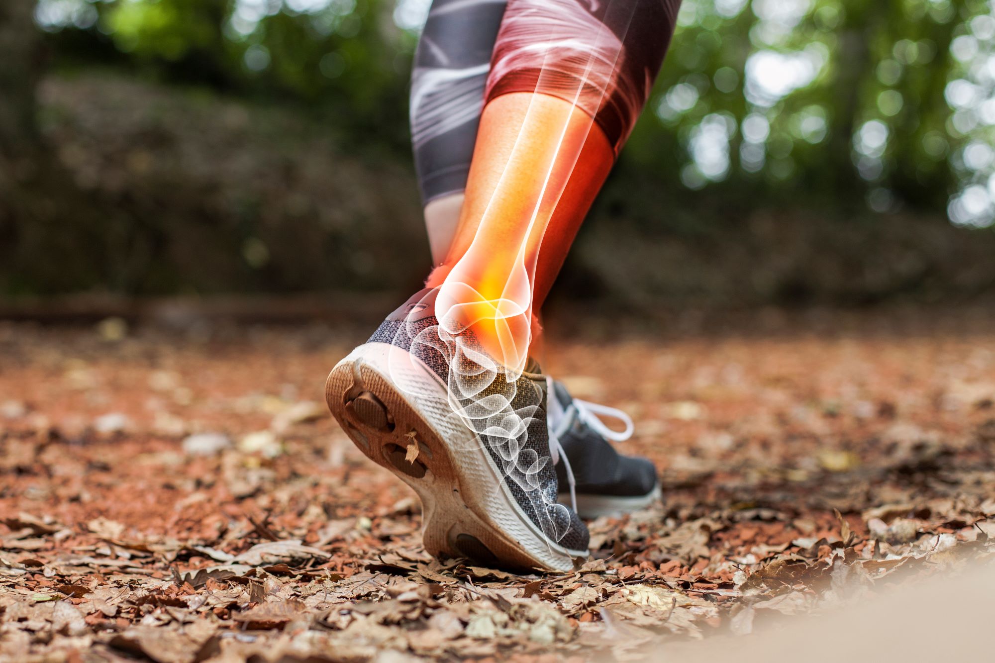 An xray image of a leg.